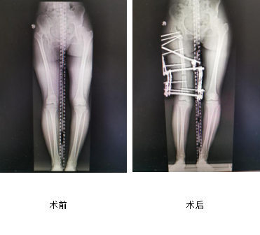 徐州仁慈醫(yī)院創(chuàng)傷骨科