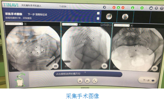 骨科機(jī)器人