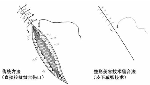 炸傷