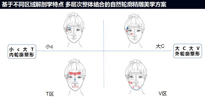 輪廓固定