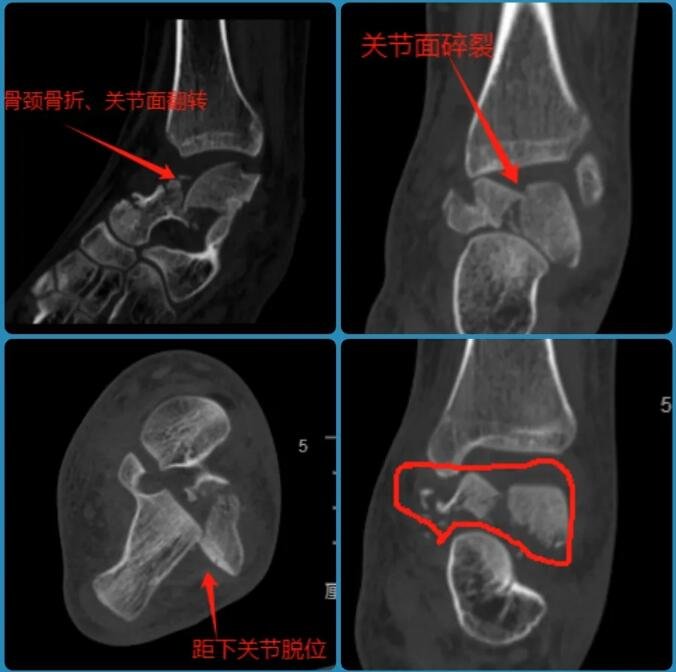 徐州仁慈醫(yī)院-足踝外科