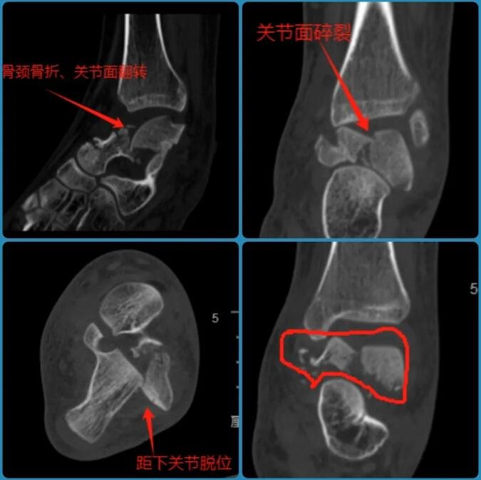 徐州仁慈醫(yī)院